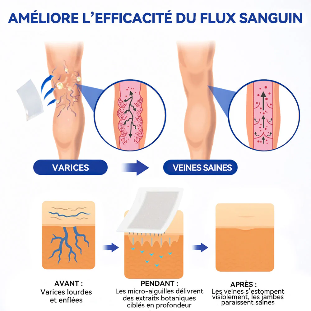 𝐏𝐮𝐫𝐞𝐥𝐨𝐫𝐚® 𝐏𝐚𝐭𝐜𝐡 𝐌𝐢𝐜𝐫𝐨-𝐀𝐢𝐠𝐮𝐢𝐥𝐥𝐞𝐬 𝐂𝐨𝐧𝐭𝐨𝐮𝐫 𝐝𝐞𝐬 𝐕𝐞𝐢𝐧𝐞𝐬 𝐚𝐮 𝐃𝐢𝐨𝐬𝐦𝐢𝐧𝐞 & 𝐀𝐞𝐬𝐜𝐢𝐧𝐞 🌿𝐑é𝐬𝐮𝐥𝐭𝐚𝐭𝐬 𝐯𝐢𝐬𝐢𝐛𝐥𝐞𝐬 𝐜𝐨𝐧𝐭𝐫𝐞 𝐥𝐞𝐬 𝐯𝐚𝐫𝐢𝐜𝐞𝐬 𝐞𝐧 𝟕 𝐣𝐨𝐮𝐫𝐬 – 𝐅𝐨𝐫𝐦𝐮𝐥𝐞 𝐯é𝐠é𝐭𝐚𝐥𝐞 𝐚𝐯𝐚𝐧𝐜é𝐞 𝐜𝐢𝐛𝐥𝐚𝐧𝐭 𝐥𝐞𝐬 𝐯𝐚𝐫𝐢𝐜𝐨𝐬𝐢𝐭é𝐬 𝐞𝐭 𝐬𝐨𝐮𝐥𝐚𝐠𝐞𝐚𝐧𝐭 𝐥𝐞𝐬 𝐣𝐚𝐦𝐛𝐞𝐬 𝐥𝐨𝐮𝐫𝐝𝐞𝐬 𝐞𝐭 𝐟𝐚𝐭𝐢𝐠𝐮é𝐞𝐬 - Image 10