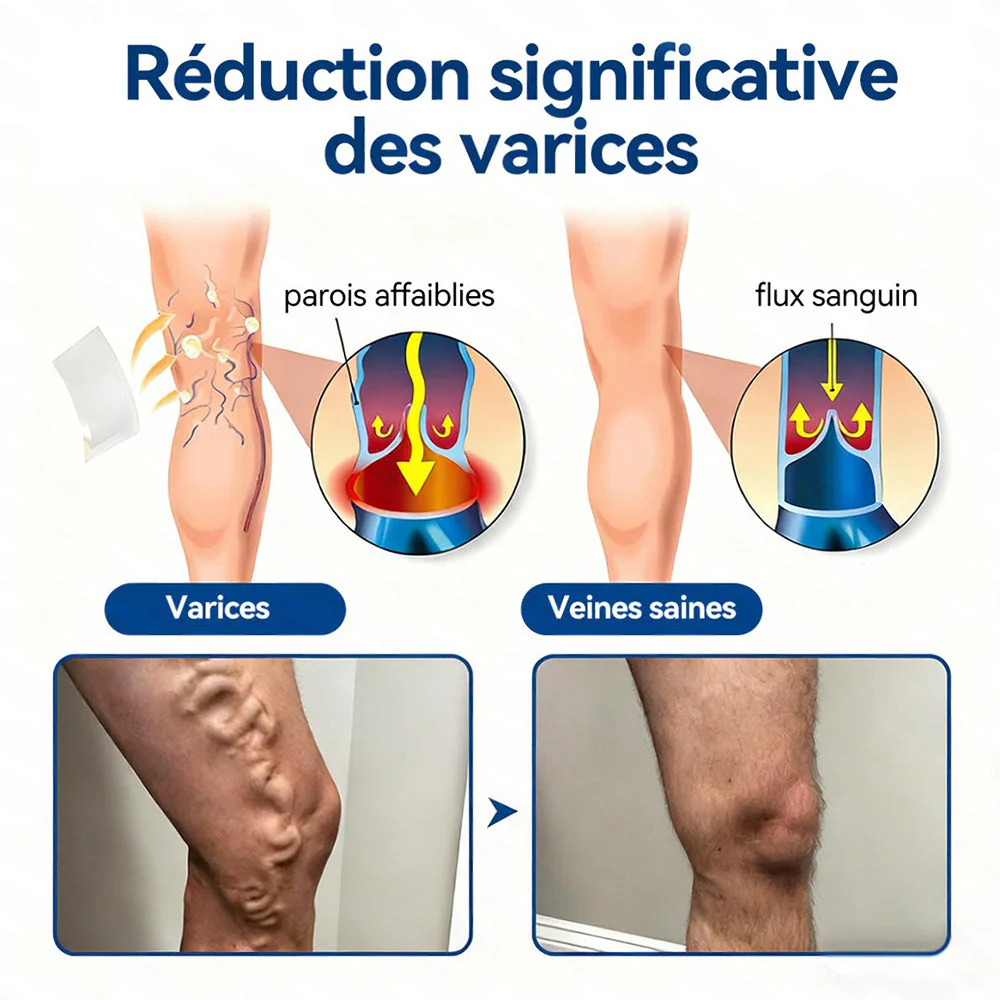 𝐏𝐮𝐫𝐞𝐥𝐨𝐫𝐚® 𝐏𝐚𝐭𝐜𝐡 𝐌𝐢𝐜𝐫𝐨-𝐀𝐢𝐠𝐮𝐢𝐥𝐥𝐞𝐬 𝐂𝐨𝐧𝐭𝐨𝐮𝐫 𝐝𝐞𝐬 𝐕𝐞𝐢𝐧𝐞𝐬 𝐚𝐮 𝐃𝐢𝐨𝐬𝐦𝐢𝐧𝐞 & 𝐀𝐞𝐬𝐜𝐢𝐧𝐞 🌿𝐑é𝐬𝐮𝐥𝐭𝐚𝐭𝐬 𝐯𝐢𝐬𝐢𝐛𝐥𝐞𝐬 𝐜𝐨𝐧𝐭𝐫𝐞 𝐥𝐞𝐬 𝐯𝐚𝐫𝐢𝐜𝐞𝐬 𝐞𝐧 𝟕 𝐣𝐨𝐮𝐫𝐬 – 𝐅𝐨𝐫𝐦𝐮𝐥𝐞 𝐯é𝐠é𝐭𝐚𝐥𝐞 𝐚𝐯𝐚𝐧𝐜é𝐞 𝐜𝐢𝐛𝐥𝐚𝐧𝐭 𝐥𝐞𝐬 𝐯𝐚𝐫𝐢𝐜𝐨𝐬𝐢𝐭é𝐬 𝐞𝐭 𝐬𝐨𝐮𝐥𝐚𝐠𝐞𝐚𝐧𝐭 𝐥𝐞𝐬 𝐣𝐚𝐦𝐛𝐞𝐬 𝐥𝐨𝐮𝐫𝐝𝐞𝐬 𝐞𝐭 𝐟𝐚𝐭𝐢𝐠𝐮é𝐞𝐬 - Image 7