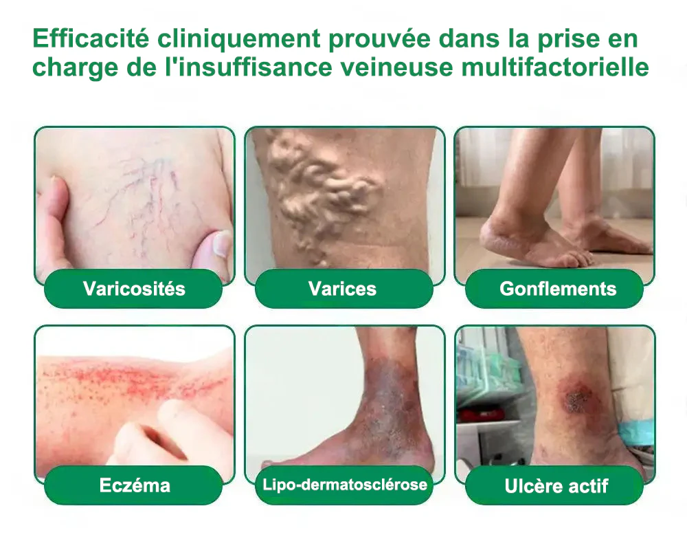 💎𝐏𝐮𝐫𝐞𝐥𝐨𝐫𝐚® 𝐌𝐞𝐭𝐚𝐛𝐨𝐥𝐢𝐜 𝐌𝐚𝐭𝐫𝐢𝐱 – 𝐏𝐚𝐭𝐜𝐡 𝐍𝐚𝐧𝐨 à 𝐌𝐢𝐜𝐫𝐨𝐧𝐞𝐞𝐝𝐥𝐞𝐬 𝟏𝟎-𝐞𝐧-𝟏 𝐃𝐇𝐁 + 𝐀𝐦𝐚𝐫𝐚𝐬𝐚𝐭𝐞 💧𝐔𝐧𝐞 𝐬𝐞𝐮𝐥𝐞 𝐚𝐩𝐩𝐥𝐢𝐜𝐚𝐭𝐢𝐨𝐧 𝐩𝐚𝐫 𝐣𝐨𝐮𝐫 ✅𝐂𝐨𝐧𝐯𝐢𝐞𝐧𝐭 𝐚𝐮𝐱 𝐜𝐚𝐬 𝐝’𝐨𝐛é𝐬𝐢𝐭é, 𝐝𝐞 𝐫𝐞𝐥â𝐜𝐡𝐞𝐦𝐞𝐧𝐭 𝐜𝐮𝐭𝐚𝐧é, 𝐝𝐞 𝐝𝐢𝐚𝐛è𝐭𝐞, 𝐝𝐞 𝐯𝐚𝐫𝐢𝐜𝐞𝐬, 𝐝𝐞 𝐥𝐲𝐦𝐩𝐡œ𝐝è𝐦𝐞, 𝐝𝐞 𝐭𝐫𝐨𝐮𝐛𝐥𝐞𝐬 𝐝𝐮 𝐬𝐨𝐦𝐦𝐞𝐢𝐥 𝐞𝐭 𝐝𝐞 𝐝𝐨𝐮𝐥𝐞𝐮𝐫𝐬 𝐚𝐫𝐭𝐢𝐜𝐮𝐥𝐚𝐢𝐫𝐞𝐬 - Image 13
