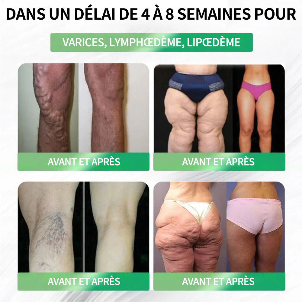 💖 𝑷𝒉𝒂𝒓𝒎𝒂𝒄𝒊𝒆 𝑶𝒇𝒇𝒊𝒄𝒊𝒆𝒍𝒍𝒆 💖 | 🇫🇷 Purelora® Patch Nano Microneedle 10-en-1 aux ingrédients naturels ✅ Aide à gérer le poids, soutient cœur, glycémie, intestin & articulations, raffermit la peau et booste l’énergie. - Image 14