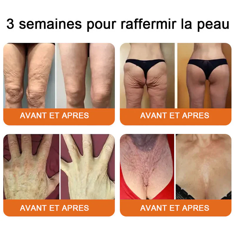 "Fabriqué et expédié de France|🐝Boutique officielle✨Purelora® venin d'abeille Crème réparatrice au 🔥 DERNIER JOUR - 80 % DE RÉDUCTION 💎" - Image 5