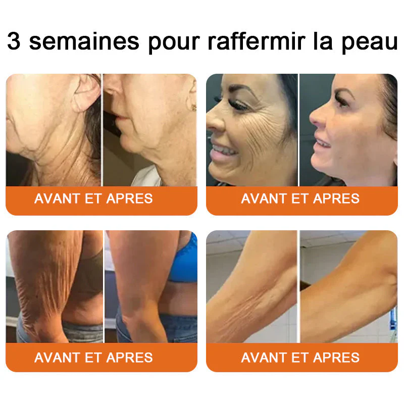 "Fabriqué et expédié de France|🐝Boutique officielle✨Purelora® venin d'abeille Crème réparatrice au 🔥 DERNIER JOUR - 80 % DE RÉDUCTION 💎" - Image 6