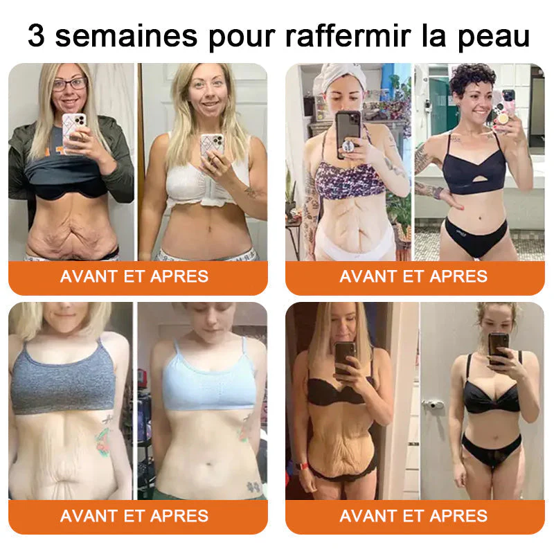 "Fabriqué et expédié de France|🐝Boutique officielle✨Purelora® venin d'abeille Crème réparatrice au 🔥 DERNIER JOUR - 80 % DE RÉDUCTION 💎" - Image 7