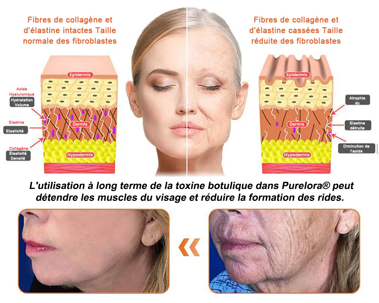 "Fabriqué et expédié de France|🐝Boutique officielle✨Purelora® venin d'abeille Crème réparatrice au 🔥 DERNIER JOUR - 80 % DE RÉDUCTION 💎" - Image 9
